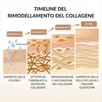 Sistema di micro-infusione per Cicatrici da Acne