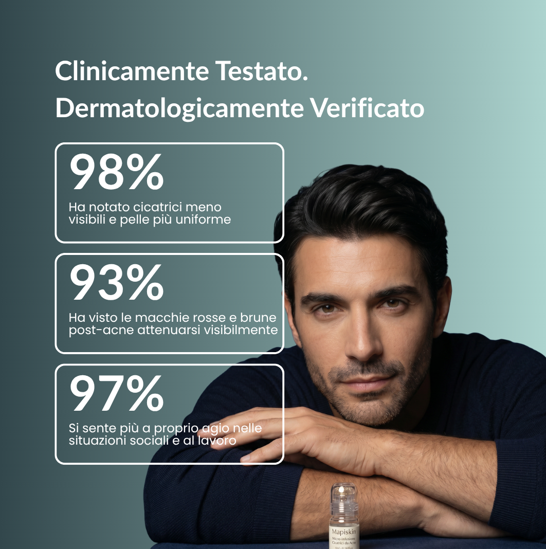 Sistema di micro-infusione per Cicatrici da Acne