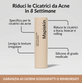 Stick Clinico per il Rimodellamento delle Cicatrici da Acne™
